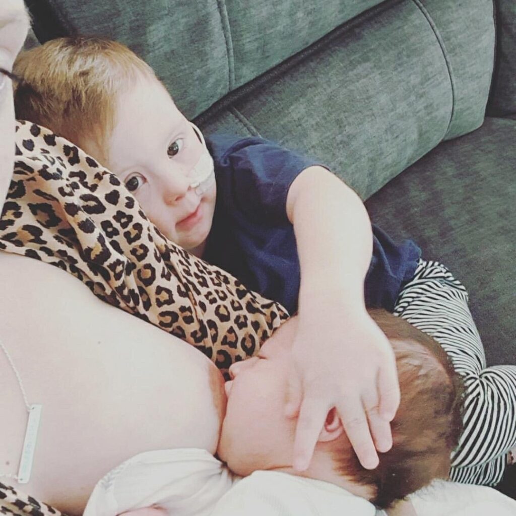Oliver down syndrome baby