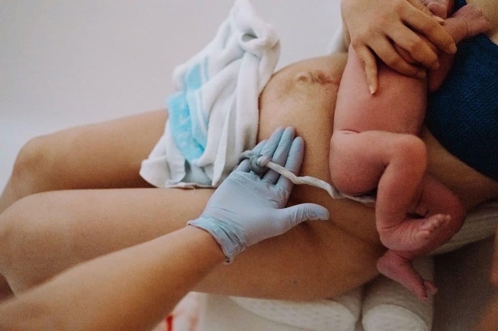 delayed cord clamping at birth