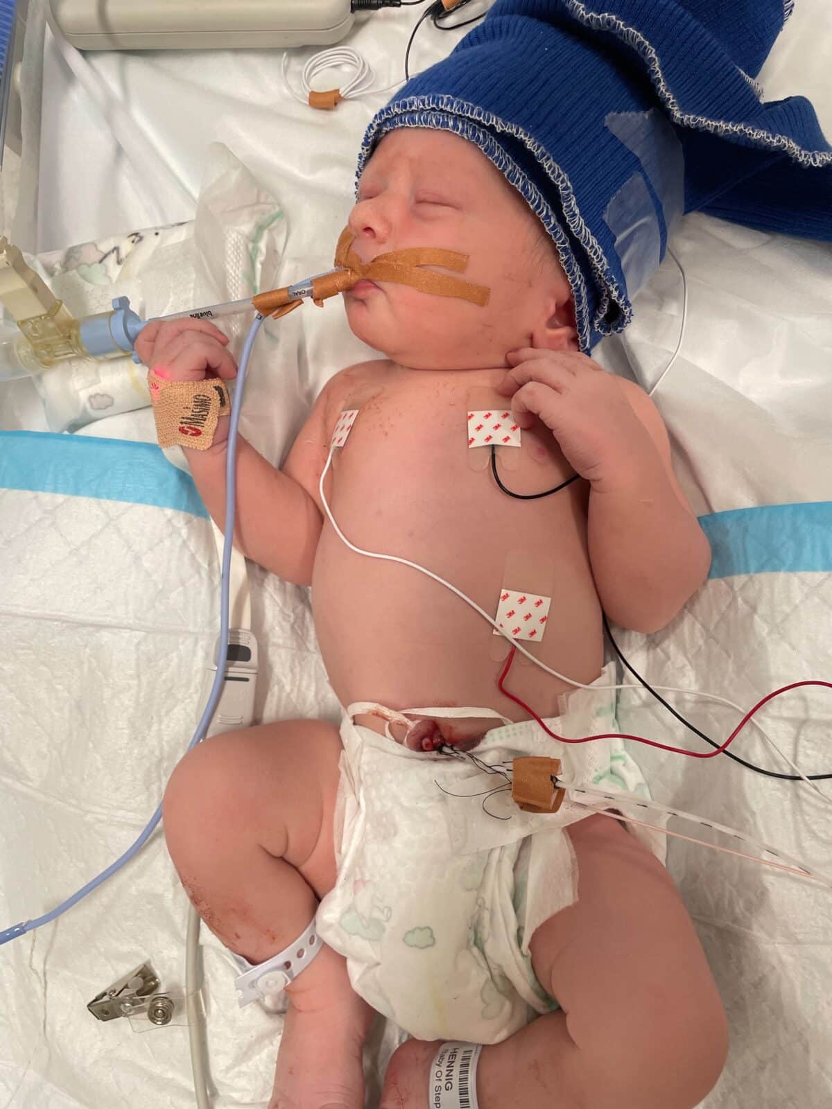 newborn baby in ICU