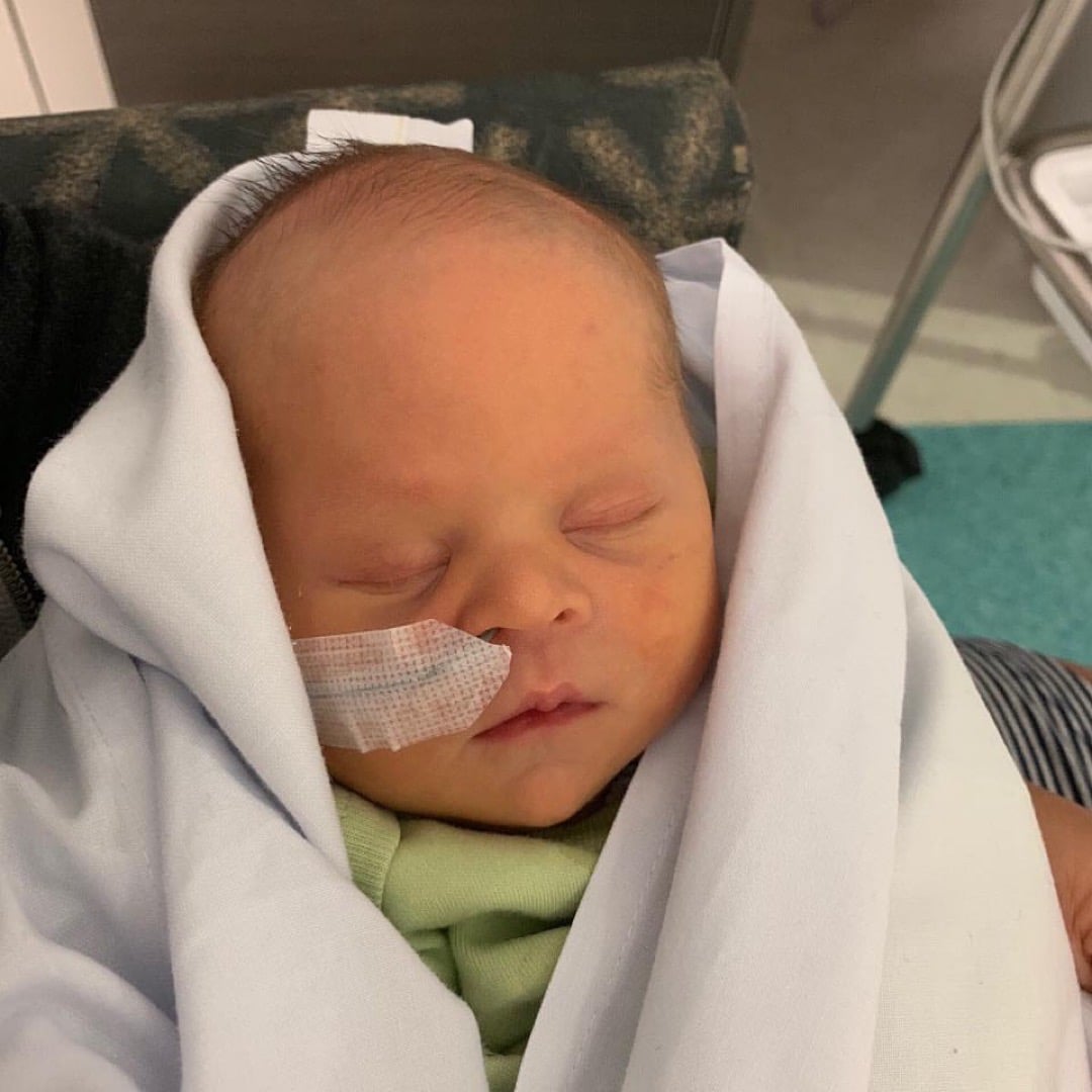 down syndrome newborn baby