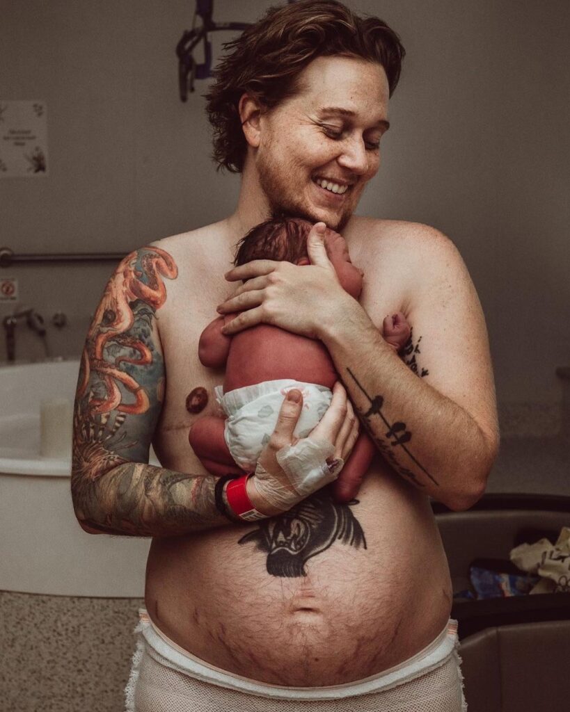 Transgender pregnancy and birth story