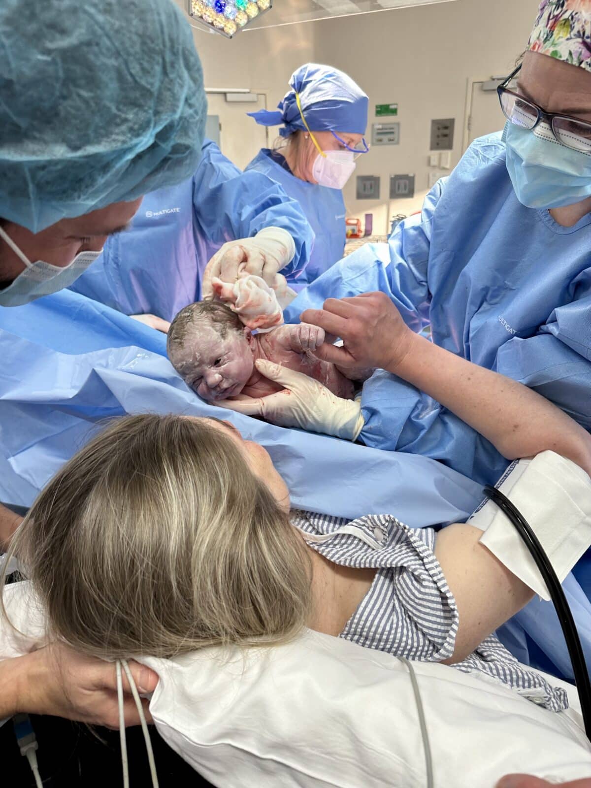 caesarean birth story with Kate